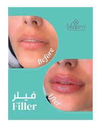 Top choice awards winner contact … Bloom Aesthetic Laser Clinic Home Facebook