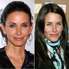 The stigma surrounding plastic surgery is disappearing as more mothers share their experiences, and why surg. Courtney Cox Plastic Surgery Before After Plastic Surgery Before And After