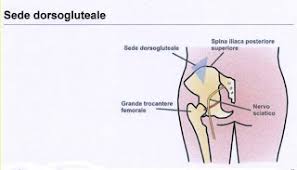 Image result for infermieristica come fare l'iniezione