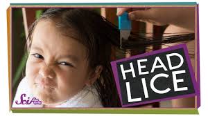 Where Do Lice Come From Louse Body Health Head Louse