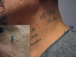 Maybe you would like to learn more about one of these? History And Epidemiology Of Tattoos And Piercings Legislation In The United States Springerlink