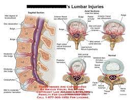 Anatomy And Physiology Stenosis Medical