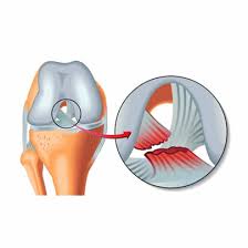 The dashboard is constantly updated and displays daily practice participation. Home Ligament Injury