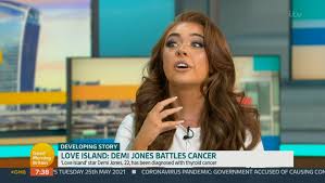 Thyroid cancer stages cancer net. Demi Jones Heartbreak As She Reveals Nasty Trolls Claimed She Lied About Her Thyroid Cancer Diagnosis