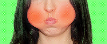 My Life As A Never-Burp