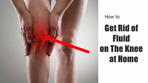 Its sanskrit name comes from three words: How To Get Rid Of Fluid On The Knee At Home Actionable Youtube