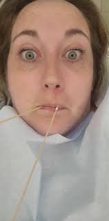 Has anyone had experience with Dr Mario Montoya for porcelain veneers?