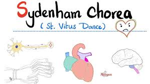 Image result for Chorea