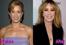 Felicity huffman plastic surgery rumors are the newest thing . Felicity Huffman Plastic Surgery Was It A Good Idea Though