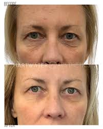 Stephanie Squires (@aesthetics_bysteph) • Instagram photos and videos