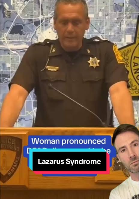 Understanding Lazarus Syndrome: A Medical Mystery