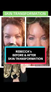 Becca Before and After