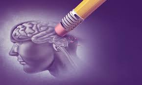 Alzheimer's disease is the most common cause of dementia — a continuous decline in thinking, behavioral and social skills that disrupts a person's ability to function independently. Ai Algorithm Accurately Predicts Alzheimer S Disease Onset