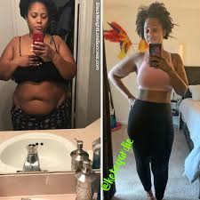 Pin On Before And After Weight Loss Stories