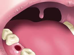Pearl powder contains dozens of minerals, including: 3 Ways To Reverse Dental Bone Loss Wikihow