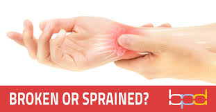 How long does a broken wrist take to heal. Broken Or Sprained Wrist Brandon P Donnelly Md