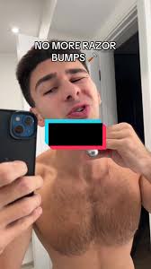 Affordable After Shave Solution for Razor Bumps