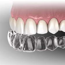 The cost of invisalign is the biggest question on everyone's mind when searching for a provider, and fees definitely vary, both by office and by geography. Invisalign Red Bank Nj Monmouth County New Jersey Michael Bixby Center For Advanced Dentistry