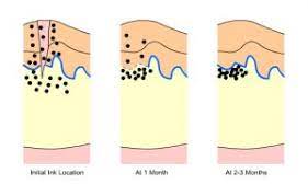 Tattoo needles don't work like the needles used in. How Does Tattooing Work Why Does Tattoo Ink Fade Over Time