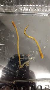 The whole day is spent restlessly, both mentally and physically. Just Found These In The Toilet After Using It Worms Phoenix Rising Me Cfs Forums