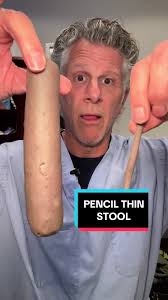 Image result for thin ribbon stools human poop