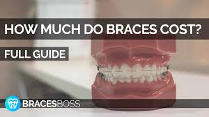 It could be a little more or less than that, depending on your situation. How Much Do Braces Cost Full Pro Guide 2021 Bracesboss