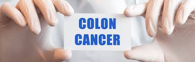 Most colon cancers occur after age 50 (unless there is a family history of the disease or a hereditary cause). Gastroenterology Archives Gastroenterologist In Cape Town Dr Deetlefs