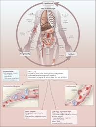 Hemorrhagic Shock | New England Journal of Medicine