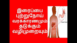 A sudden new mole, for red moles cancer symptoms. à®à®° à®ª à®ª à®ª à®± à®± à®¨ à®¯ Stomach Cancer Symptoms In Tamil Cancer Symptoms à®à®° à®ª à®ª à®ª à®± à®± à®¨ à®¯ à®à®± à® à®± à®à®³ Youtube