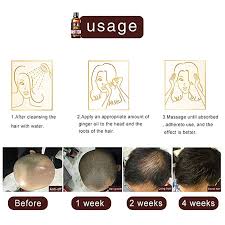 In addition to that, growth rate of hair is affected by gender, age, hair color and ethnicity too. Dageda New Ginger Hair Growth Oil Essence Stops Hair Loss Dense Thicken Hair Treatment Balding Supports Healthy Hair Growth For Women Men 30ml By Dageda Shop Online For Beauty In