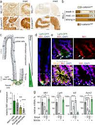 If your cat's bowel cancer is caught early and hasn't yet spread to other parts of his body, then surgery may be an effective treatment option. The Epigenetic Regulator Mll1 Is Required For Wnt Driven Intestinal Tumorigenesis And Cancer Stemness Nature Communications
