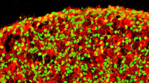 The following content was provided by scott a. Research Advances One Step Closer To Stem Cell Therapy For Type 1 Diabetes Salk Institute For Biological Studies