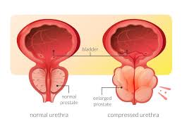 Image result for Prostate Anatomy