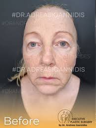 𝐃𝐫. 𝐀𝐧𝐝𝐫𝐞𝐚𝐬 𝐈𝐨𝐚𝐧𝐧𝐢𝐝𝐞𝐬