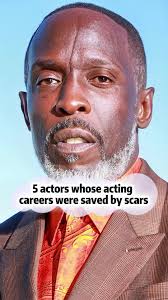 5 Actors Whose Acting Careers Were Saved by Scars. #tommyflanagan #mic...