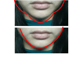 Secretos Caseros Para Adelgazar La Cara Remedios Caseros Naturales Para Bajar De Peso Rapido Anímate a reducir desde la comodidad de tu casa sin necesidad de asiste a molestias y costosas terapias de estiramiento y de una forma sencilla y que a. plan de dieta cetosis de perdida de peso