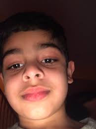 Venu Reddy Aella (@VenuAella)