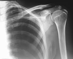 Pin On Musculoskeletal Radiology