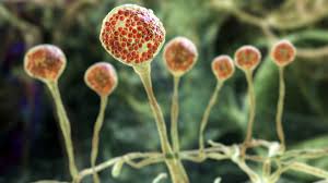 Das coronavirus trifft indien besonders hart. Schwarzer Pilz Breitet Sich Weiter Aus Todliche Pilzerkrankung Lasst Menschen Erblinden News De