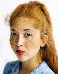 Having the colour of ginger. Documenting Gingers Of Color
