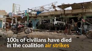 Image result for yemen children