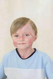 Our precious little Reid passed away peacefully yesterday in the arms of  Audra, Avery, Barrett and me in our home. Reid battled every day of his  life and is finally free of