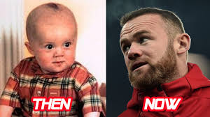 The transfer fee was £25.6 million. Wayne Rooney Before And After Hairstyle Body Hair Transplant Youtube