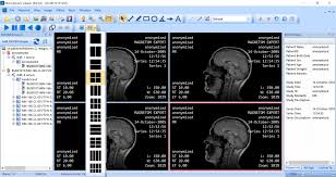 I keep getting message i need to log in as administrator. Microdicom Free Dicom Viewer And Software