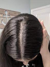 Are you frustrated due to the aggravated dandruff problem? 18 Of The Best Shampoo And Conditioner Sets You Can Get On Amazon