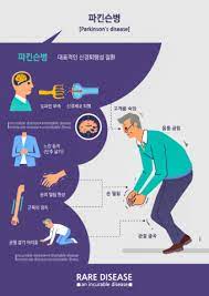 Check spelling or type a new query. í•œ ë²ˆ ì²˜ì¹˜ë¡œ ë‡Œì„¸í¬ ìƒì„±í•´ íŒŒí‚¨ìŠ¨ë³' ì¹˜ë£Œ Sciencetimes