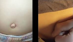 Big Outie vs Innie - You Decide