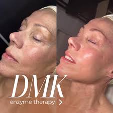 you deserve this. #skinbybta