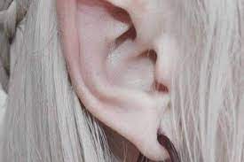 Forked ears, lurid skin shades, uncuttable hair, or horns that resemble a crown (not really horns). Pointed Ears A New Fashion In Plastic Surgery On The Rise Gulftoday