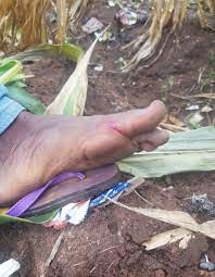 Sep 21, 2020 · awolowo leaf is commonly seen around most homes as a weed and most times we often take them off without knowing the health benefits. Using Akintola Leaves Chromolaena Odorata To Treat Fresh Wound Peakd